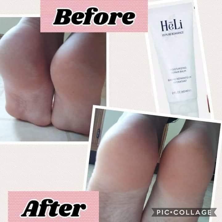 HēLi Moisturizing Repair Balm (Bálsamo reparador humectante)